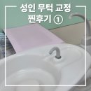 평택드림테크 | 성인무턱교정 후기 ①┃발치교정, 수면무호흡, 턱관절 스플린트, 양악 고민에 이어 비수술 교정을 결정...