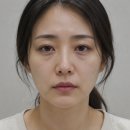 황종익 | 압구정티타늄리프팅, 후기보기 전에 확인해보세요