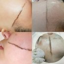 야시손톱 이미지