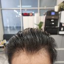 남자는 머리빨? 남자 붙임머리도 가위자비
