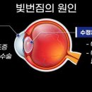 라메종옵티크 이미지