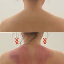 6392 | 배곧 신부관리 예식 전 필수 드레스라인 관리 내돈내산 만족후기