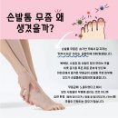 리멤버피부과의원 양주옥정 네이버블로그