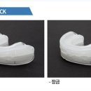 덴트Q