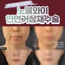 노블성형외과의원 이미지