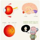 녹내장진단비보장 특별약관과 백내장진단비보장 특별약관의 비교 이미지