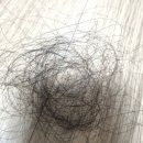 모본한의원 | 강남탈모치료 모본한의원 8회차 후기