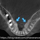 연희세브란스치과의원 이미지