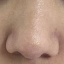 참존약품 | 참존 컨트롤 마사지 크림 내돈내산 [ 블랙헤드 없애는법 , 피지 제거 ]