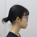 미소핀의원 | 비수술 주걱턱 교정의 장단점은 무엇인가요?