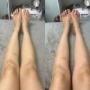 힐스템 수면 힐링샵 | 천안 불면증, 과도한 스트레스로 잠 못 잘 때 해결법! 영바디케어 뇌힐링테라피 후기