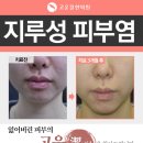 고운결한의원 | 분당 피부과 고운결한의원