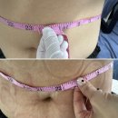 MK토탈뷰티&아카데미 | 김포 복부관리 내돈내산 후기 윤슬아토탈뷰티 인비덤 복부관리 받고 왔어요