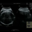 밝은미래산부인과의원 이미지