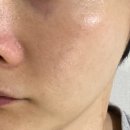 [메디카미, MediCami] 실크 루미어 크림, 좁쌀 여드름...율무씨추출물 피부 톤 정리 크림 사용해 본 후기