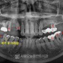 서림동-14 이미지