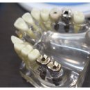 이수치과기공소 이미지