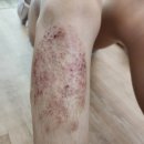 최성진내과의원 | 포항 최성진내과의원 방문