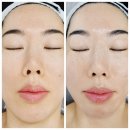 평택고덕피부관리 닥터수 평택고덕점 수비테라피 스폐셜 찐후기