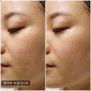 인셀덤 화장품 사용방법 및 꿀피부 도전 사용후기