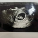 신촌연세퀸산부인과의원 이미지