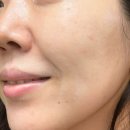 베스트메디필 | 메디필랩핑마스크 역시 올리브영 베스트 제품 메디필물광리프팅팩