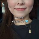 대함 | 보조개수술 절개 후 당일부터 5일차까지 내돈내산 리얼후기