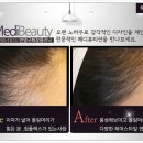 예지미헤어 - 미추홀구 | 예지미헤어