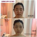 인제대피부관리 시간을 되돌리는 볼륨리프팅 빈스뷰티 리얼후기