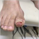 미엘네일 이미지