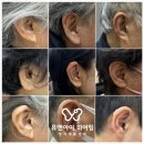 유앤아이히어링;유앤아이보청기청각센터