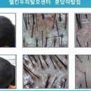 웰킨두피탈모센터분당