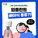 교대역인앤인오피스 | 임플란트 뼈이식 통증, 얼마나 아플까? 회복 기간과 주의사항 총정리