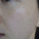 코자요03 | 올리브영 기미 잡티 크림 다 써본 1년차 후기💧결국 정착한 건 따로 있었어요 (슈퍼젝션크림)
