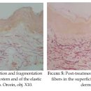 (주)에이메가 | 피부과전문의가 스티바에이 대신 여드름 약을 먹는 이유