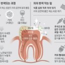 한미치과 네이버블로그