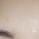 영플러스메디칼 이미지