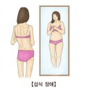 식이장애 [eating disorder] 이미지