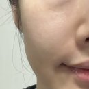 한국바이오초크 - 익산시 선화로 234 | 겨울앰플 추천, 촉촉하게 탄력 끌어올리는 아이스트 히알샷 푸쉬업 퍼밍 앰플;실프팅앰플로 어려져요...