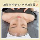 피부애반하다