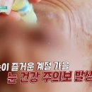 실명까지 초래한다?! 황반변성 - 시야가 흐릿하고 초점이 일그러진다면 의심해야 할 안질환?! 이미지