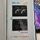 유가네닭갈비 정관점 | [임신일기ㅣ임신기록] 35주차~36주차 / 막달검사, 이사, 아빠보러 영락공원