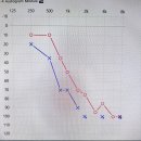 시그니아독일보청기관악센터