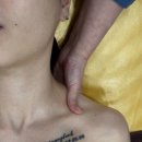 미백세탁 | 부산 서대신동 슈퍼젝션관리 맛집 리에스테틱 하이드론젝션 피부관리 솔직후기