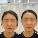 (유)초록환경 | 신용동 피부관리 | 광주 윤곽관리 추천, 유뷰티 알테온 관리 받고 온 후기