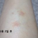 디비씨