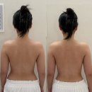 청담에너지 | 청담에스테틱 디유에스테틱 프리베 청담점에서 경혈에너지테라피 받고온 후기