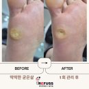 리숍 | 50대 남성 딱딱한굳은살제거 발각질 관리 진짜 후기