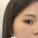 청담에스민의원 | 청담동피부과 레이저 여드름흉터 주근깨 기미 제거 예신 물광피부 (정보문의환영)