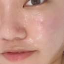 (주)헤이메디칼 | 운정에서 웨딩관리샵으로 유명한 리틀헤이나에서 관리받았어요!~